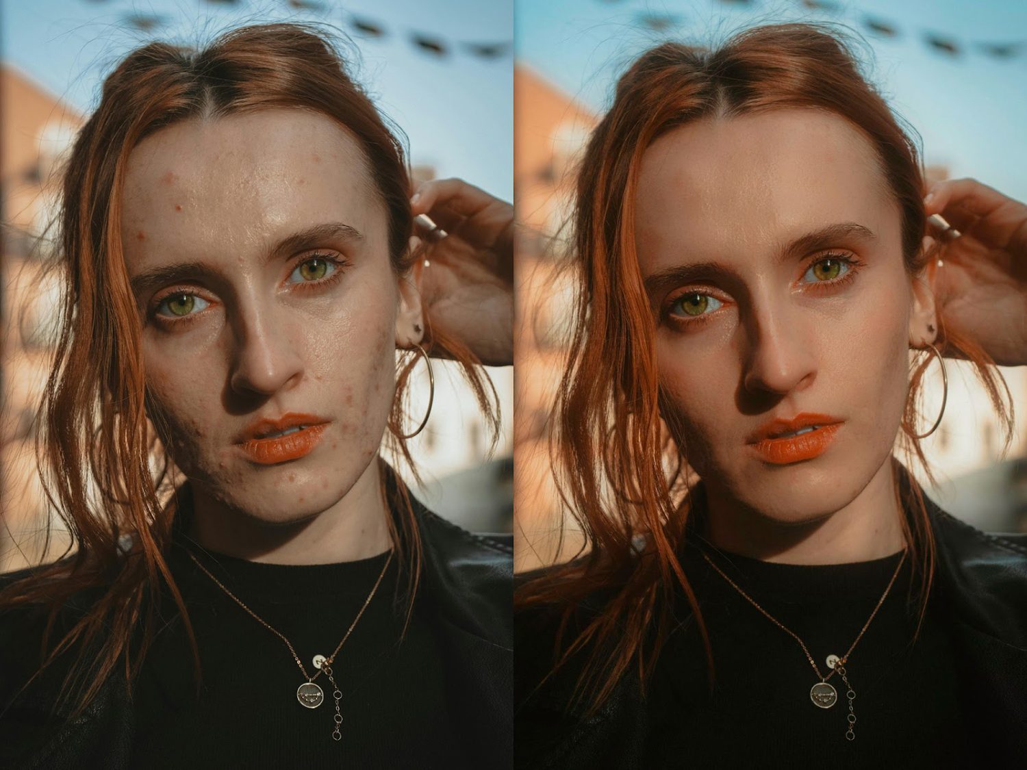 ispolzovanie neyronnyh setey dlya avtomaticheskogo udaleniya defektov kozhi na fotografiyah