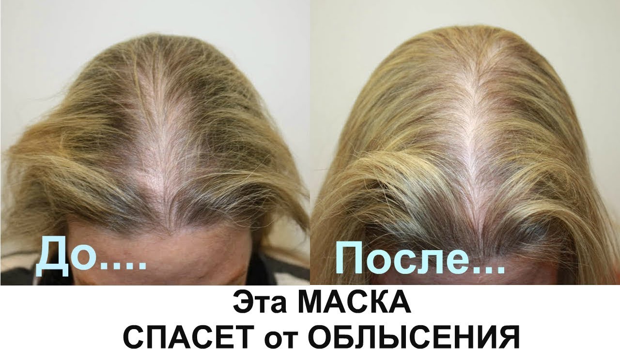 maskirovanie volos i drugih slozhnyh obektov